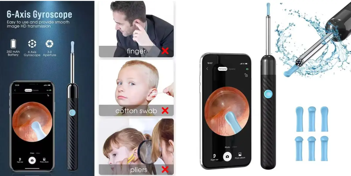 Ear Wax Removal Kit – 8-Piece Ear Cleaner with 1080P Camera, 6 Ear Spoons, iOS & Android Compatible